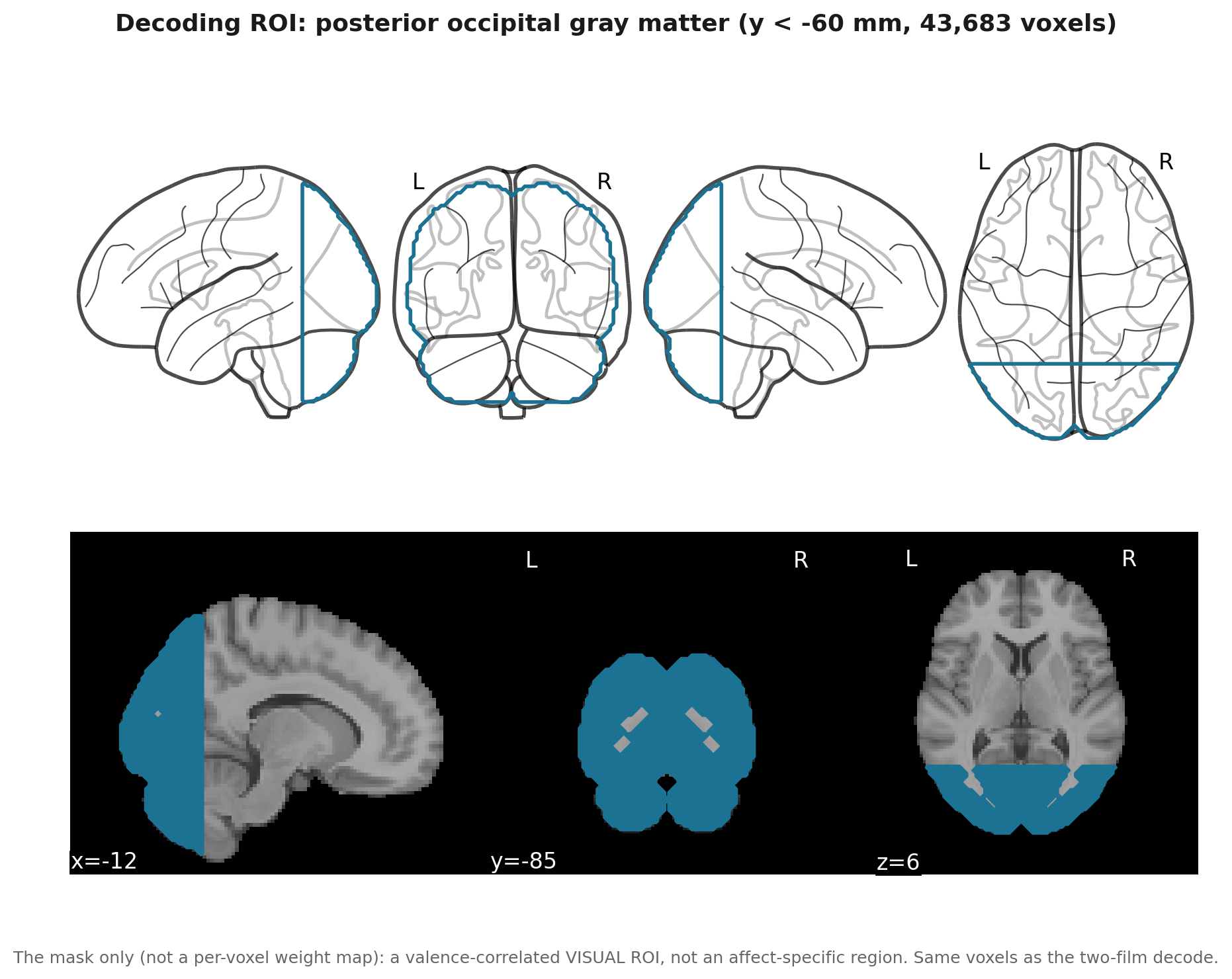 Brain ROI: posterior occipital gray matter, 43,683 voxels, a visual region.